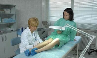 comment traiter les varices dans les jambes